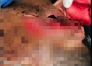 Pelaku Penganiayaan Berat di Tarabintang Masih Buron, Diduga Mantan Anggota Polda Sumatera Utara